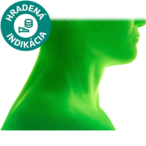 Skvamocelulárny karcinóm hlavy a krku HNSCC